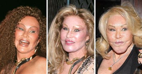 jocelyn wildenstein before after.